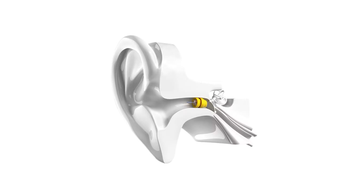 Invisible hearing aid pioneer Lyric is fast out of the gates